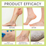 Soothing & Relaxing Joint Cream, Balm for Swollen Legs, Organic Miracle Balm - Natural Ingredients, Soothing Joint Cream for Back, Hands, Feet and Body